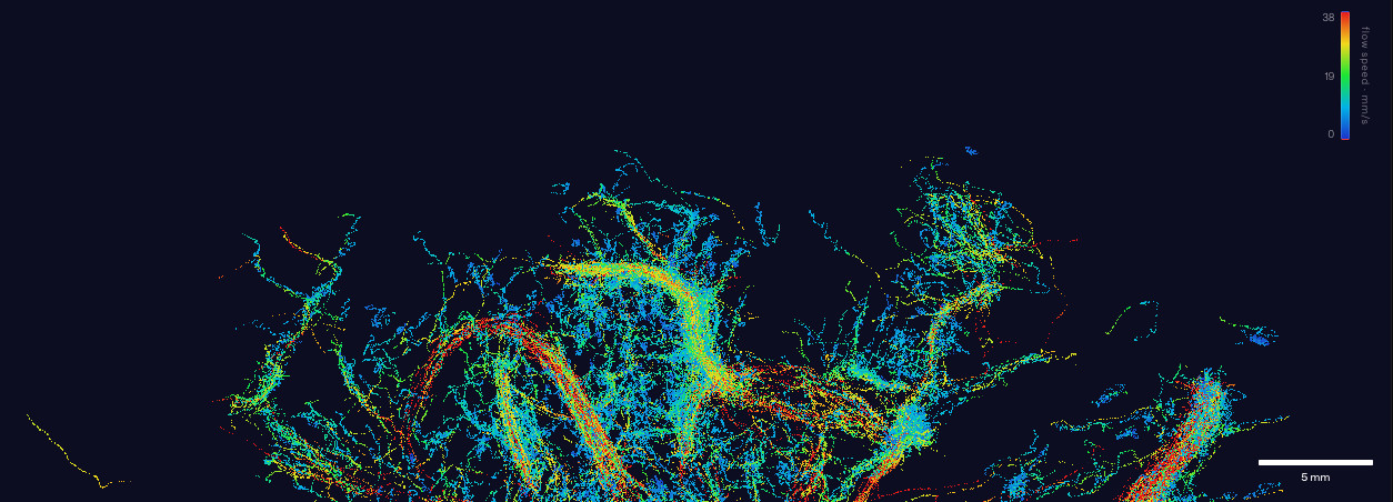 Ricostruzione 3D della microvascolarizzazione di un cervello umano vivo a ultrasuoni attraverso il cranio, con i vasi colorati in base alla velocità del flusso sanguigno